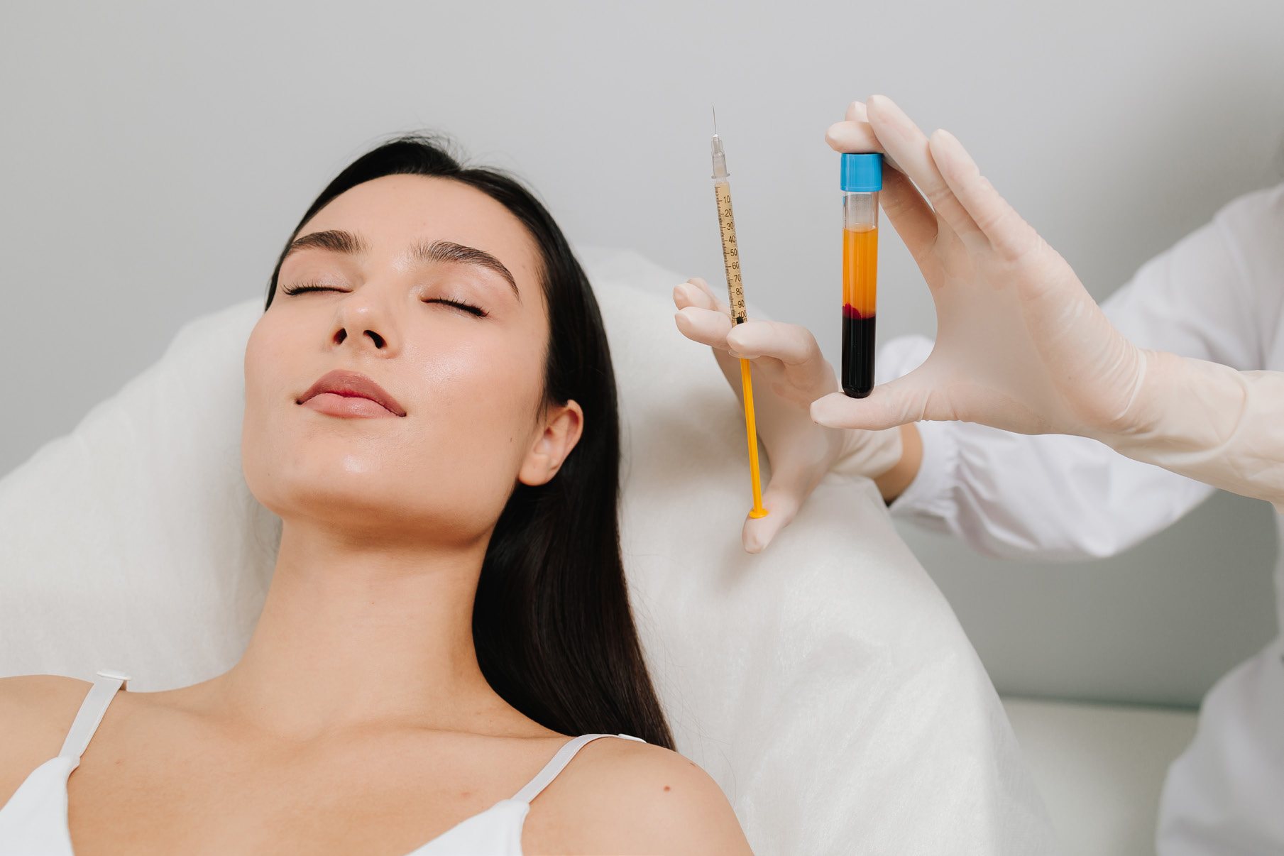 PRP facial — bioestimulación de la piel